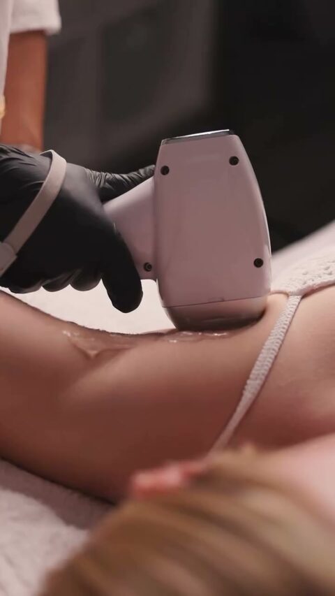 Laser-Handstück während der Behandlung einer Körperzone